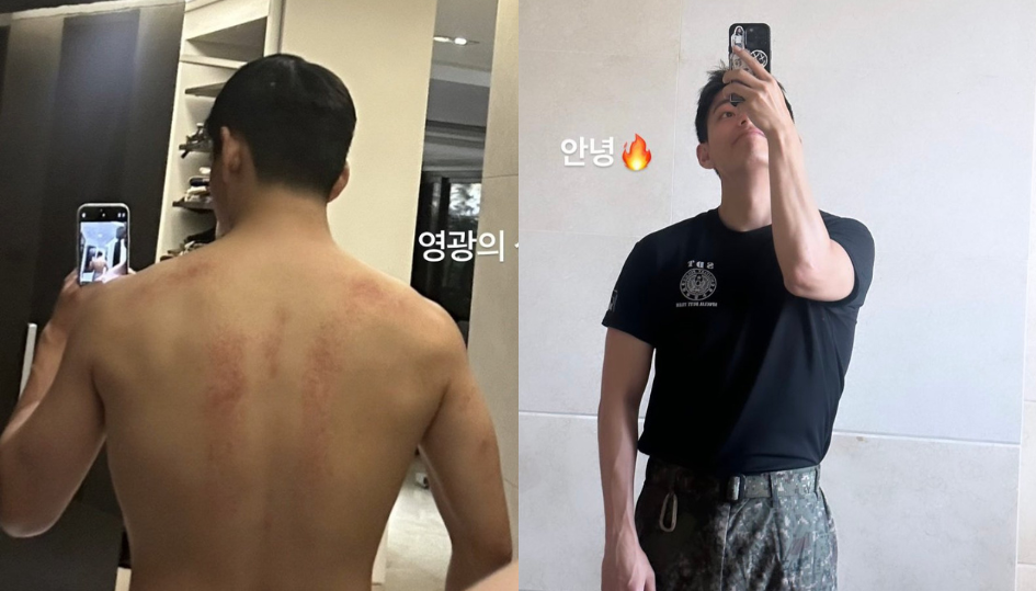 BTS金泰亨秀出在特種部隊期間留下的疤痕和健壯體魄！